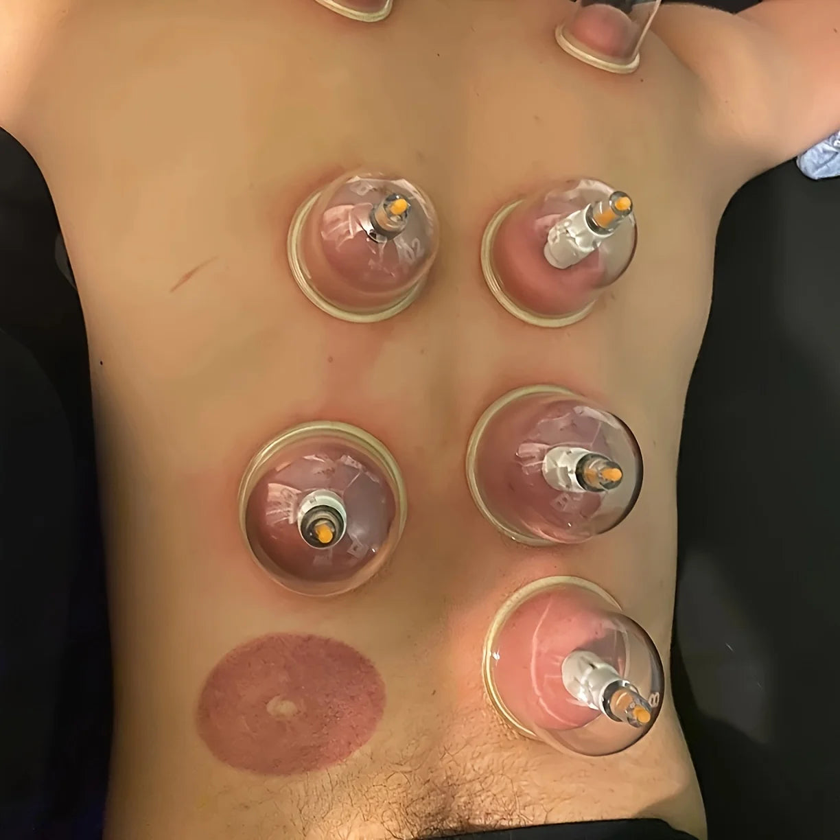 24/12Pcs Cupping Relaxation Set: Cupping Cups in Various Sizes, a Manual Pump, and a Detailed Guide. Cupping Set for Massage